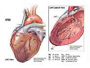 Heart Anatomy Medical Illustration Medivisuals