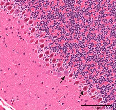 Histology Of Cerebellum Ppt - Human cerebellum @ 40x showing the Molecular and Purkinje ... / 5 ...