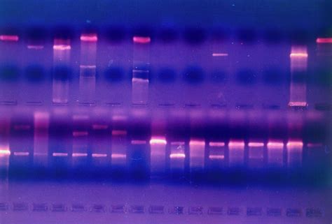 Burning Bright: A Brief History Of Ethidium Bromide DNA