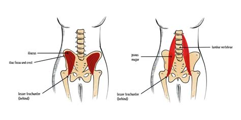 Tight lower back? It could be a psoas trigger point