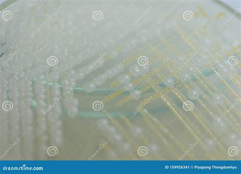 Colony Characteristics of Yeast in Petri Dish. Stock Image - Image of ...