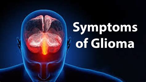 Symptoms of Glioma - YouTube