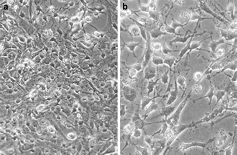 Primary mix glial cell culture after 14 days observed by an inverted... | Download Scientific ...