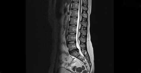 Orthopedic MRI - Zwanger-Pesiri Radiology