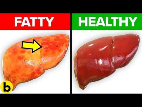 foods to avoid with enlarged spleen and liver - Fastens Binnacle Galleria Di Immagini