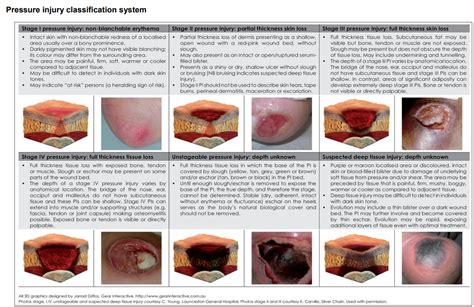 New EMR pressure injury classification resource