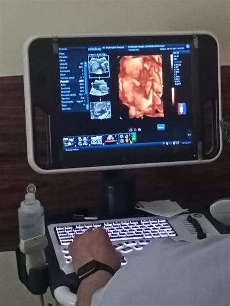 Ultrasound Tech: Explore the World of Sonography