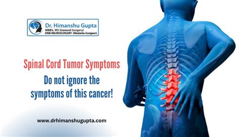 9 Main Symptoms of Spinal Cord Tumor - Dr. Himanshu Gupta