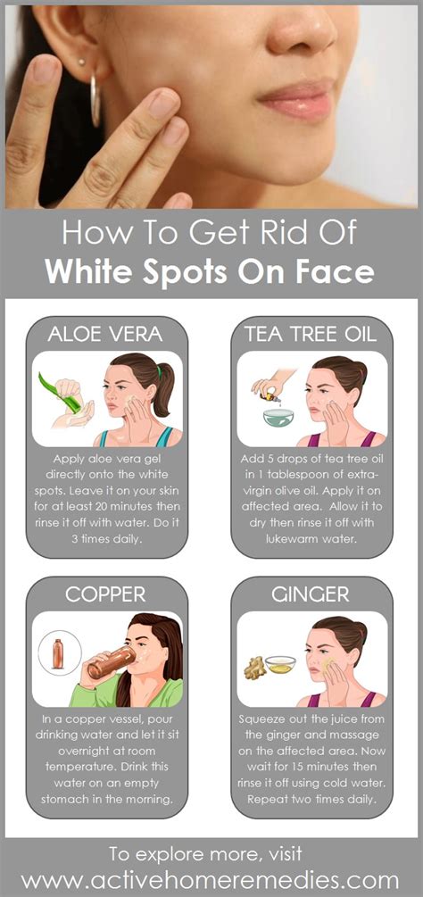 How to Get Rid of White Spots on Face | Active Home Remedies