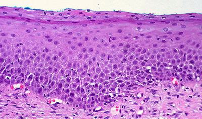 Uterus Histology - Ectocervix - histology slide