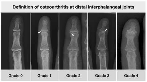 Diagnostics | Free Full-Text | Osteo-Proliferative Lesions of the ...