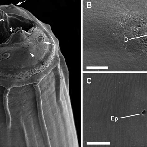 Scanning electron microscopy of Physaloptera retusa. (A) Anterior... | Download Scientific Diagram