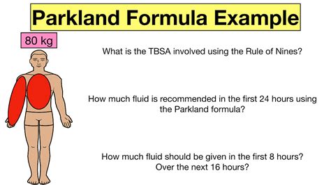 Parkland Formula for Burns: Pediatric and Adult Examples, Calculator, Practice Questions — EZmed