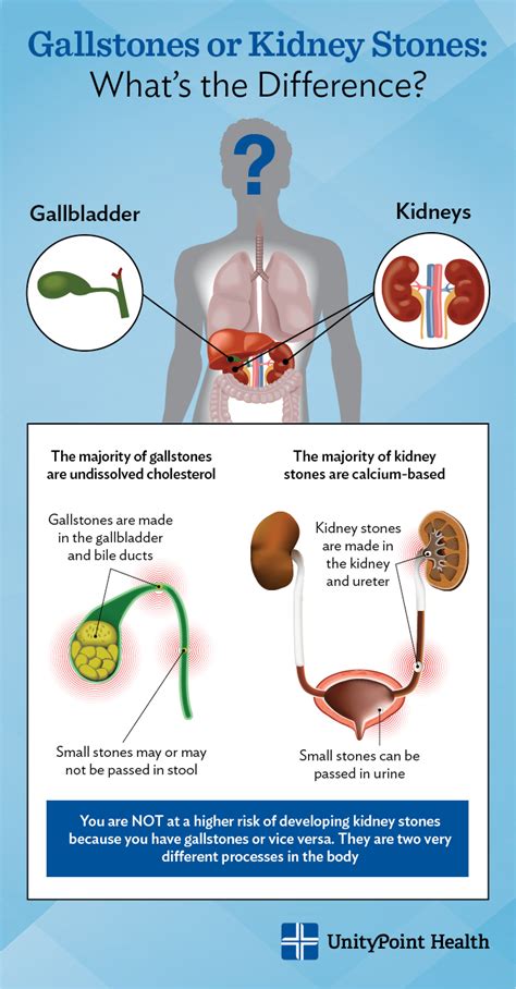 Gallbladder Pain Location Diagram - exatin.info