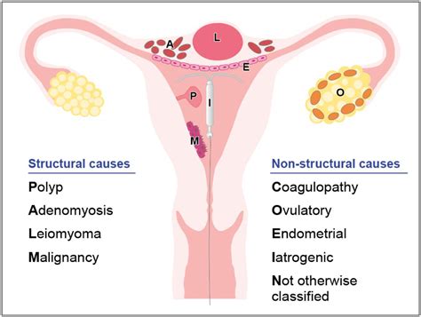 Biomarkers in abnormal uterine bleeding†