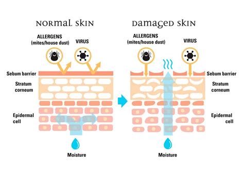 What Is The Skin Barrier and Why You Should Care About It