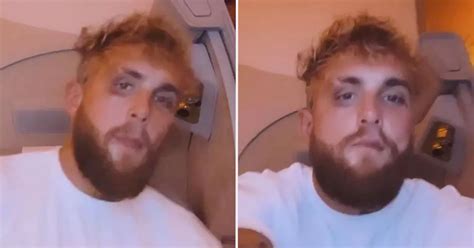 Jake Paul shows off black eye he suffered in boxing defeat by Tommy ...