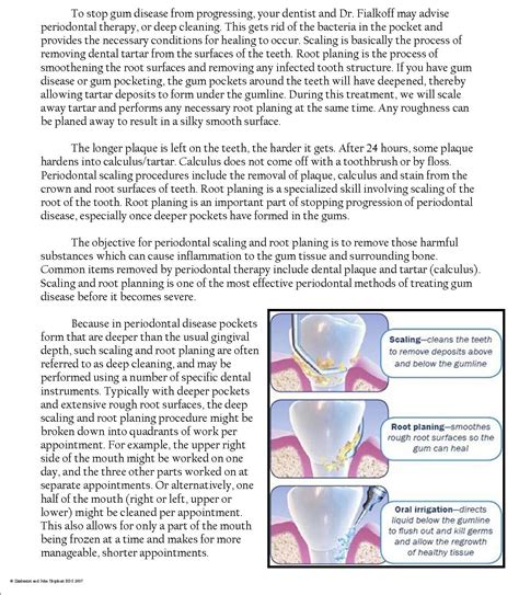 Scaling & Root Planing - Dr. Bernard Fialkoff