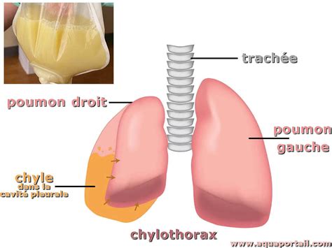 Chyle : définition et explications