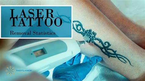 Laser Tattoo Removal Statistics From Skin Care Experts | Indy Laser