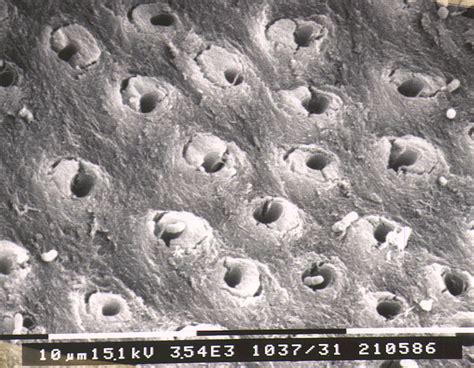 Peritubular dentine in dentinal tubules, cross section - Anatomicum.com