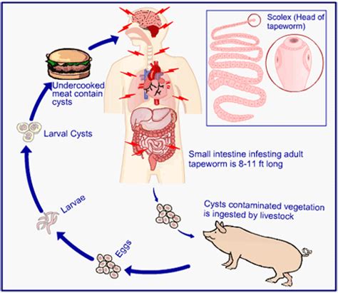 Which of the following is a tapeworm ? / निम्नलिखित में से कौन एक टैपवार्म है? - Biology