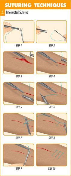 Surgical Suturing Techniques Mastery Guide - Apprentice Doctor | Suture techniques, Suture kit ...