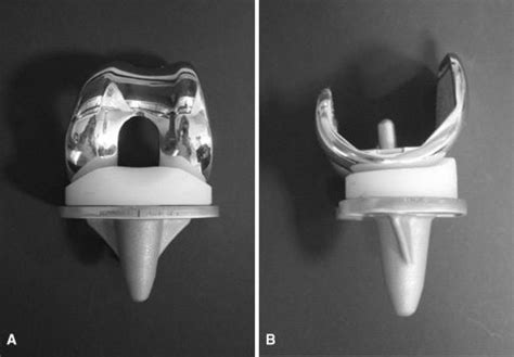 DePuy Attune Knee Replacements – Tibial Loosening