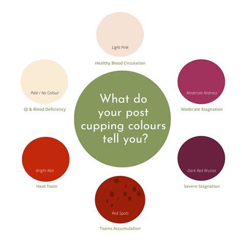 Cupping Therapy Color Chart