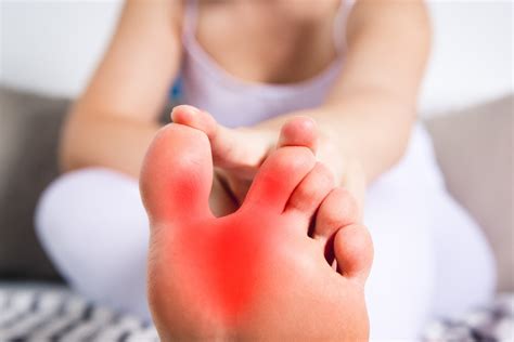 7 Home Remedies for Gout Foot & Toe Pain | Fort Myers Podiatrist