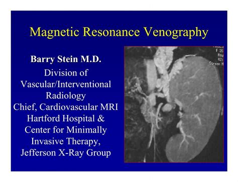 Magnetic Resonance Venography