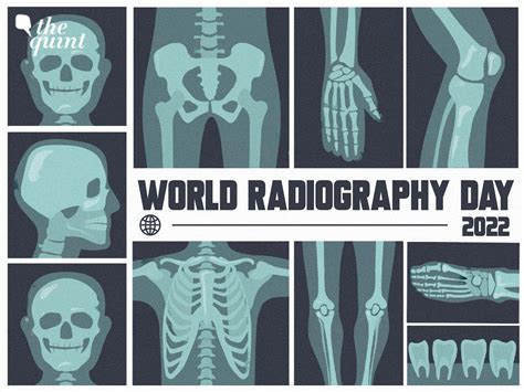 World Radiography Day 2022: Theme, History & Significance