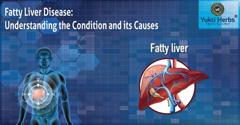 Fatty Liver: Understand Fatty Liver Condition and Causes