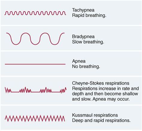 28. Oxygen needs | Nurse Key