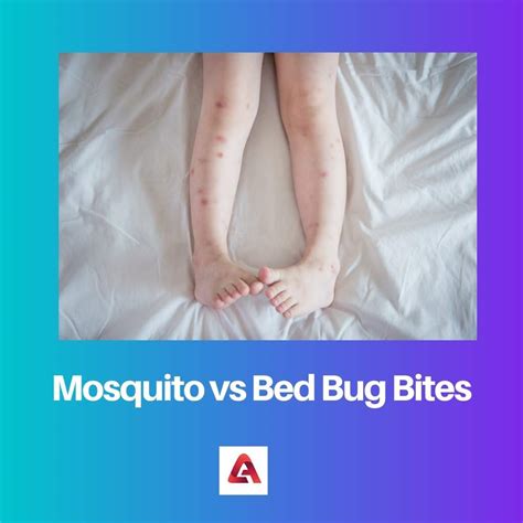 Difference Between Mosquito and Bed Bug Bites