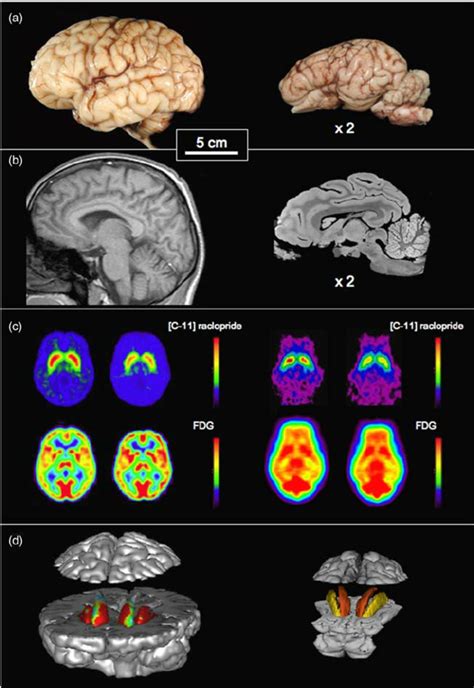 Comparison of human (left) and pig (right) brain images. (a) Ex vivo... | Download Scientific ...