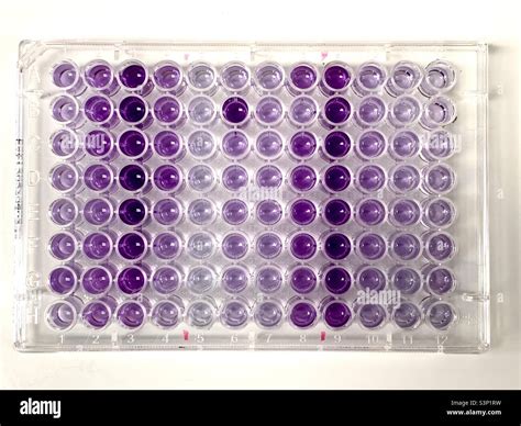 Colorimetric Immune assay in 96-wells plate in laboratory Stock Photo - Alamy