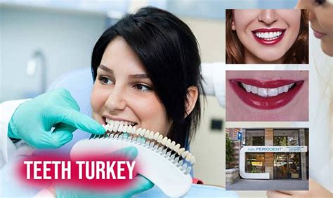 Get Your New Teeth in Turkey: The Best Smile Makeover