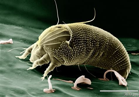 Demodex Mites - Scabies-Killer.Com