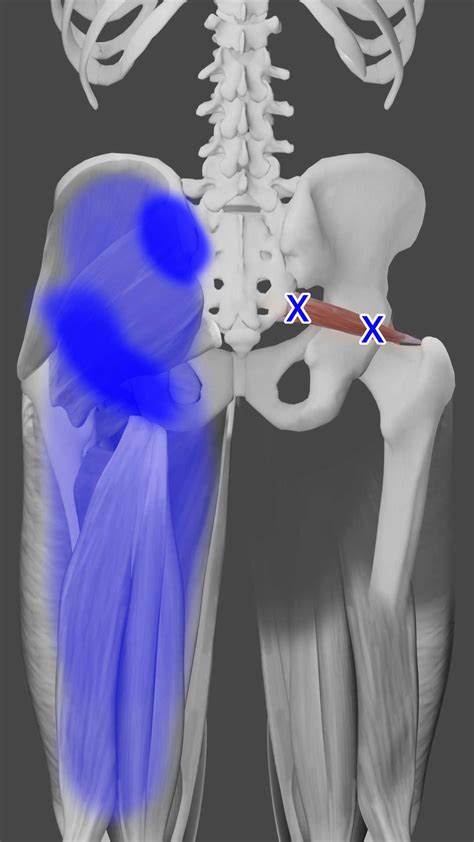 Piriformis Trigger Points