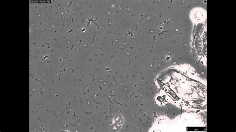 Human saliva viewed using an inverted microscope, in bright field phase ...