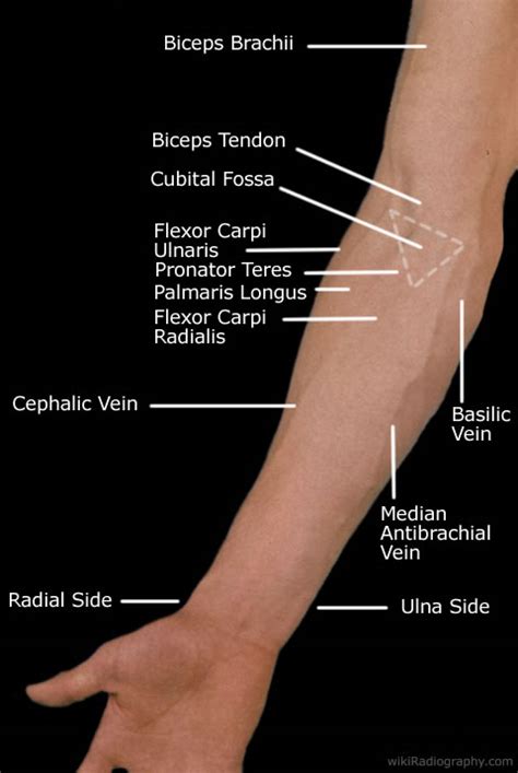 wrist bony anatomy