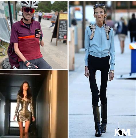 Top 10 Skinniest People In The World 2022 - Kenyan Magazine