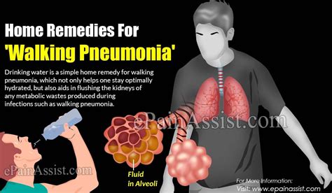 Home Remedies For 'Walking Pneumonia' | Walking pneumonia, Pneumonia ...