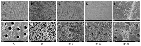 SEM images of S. mutans biofilms grown on dentin discs after surface ...