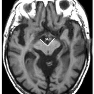 Non-oblique axial CT or MRI slices. | Download Scientific Diagram