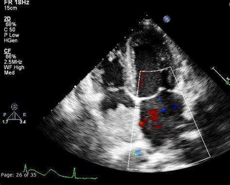 Image | Radiopaedia.org