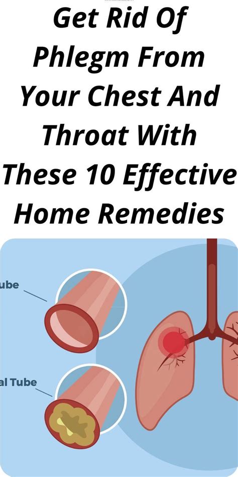 Home Remedies For Phlegm In Throat