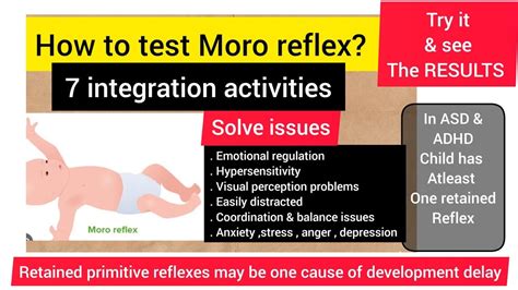 Moro reflex/issues if retained/How to test Moro reflex & 7 integration activities/primitive ...