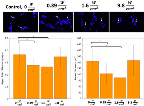 Chromatin Condensation Induced by Ultrasonics. Chromatin structure ...